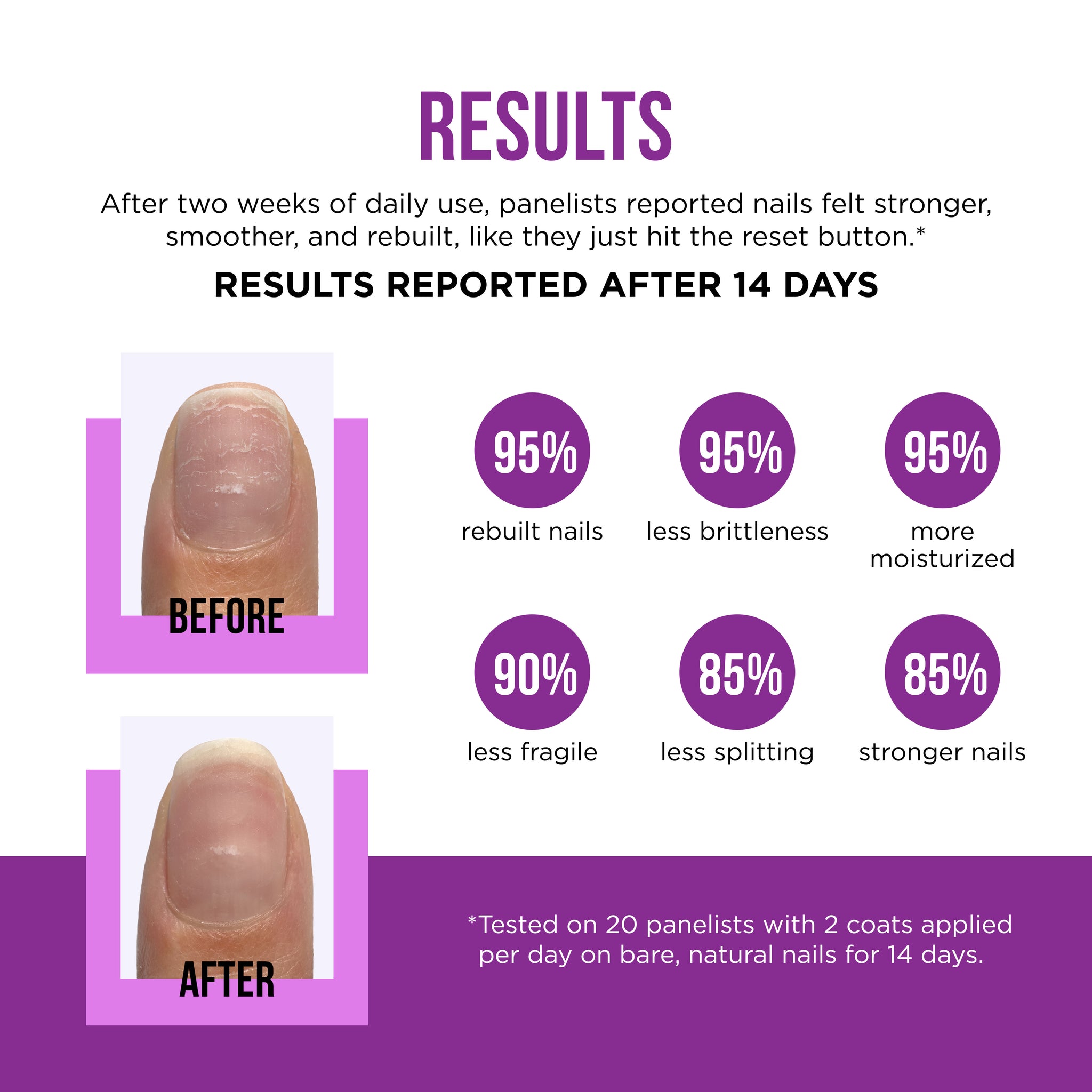 Nail Rescue® Bond Repair Serum
